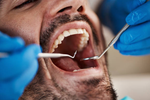 Best Urgent Tooth Repair  in Wolfe City, TX